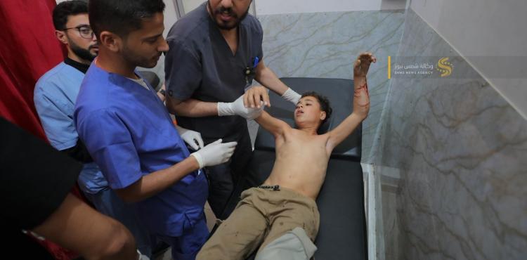 اصابة برصاص الاحتلال