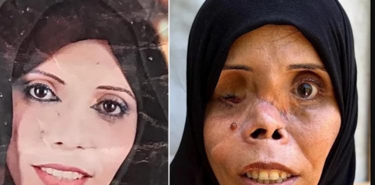 مأساة المواطنة نجوى أبو عطيوي .jpg