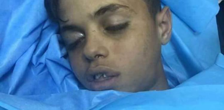 الطفل الشهيد محيي الطباخي