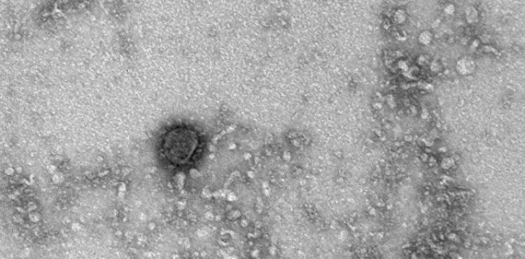 صور جديدة لفيروس "كورونا"