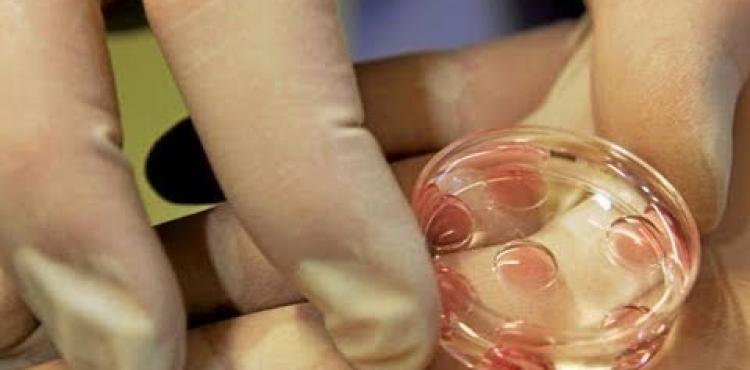 تجميد البويضات