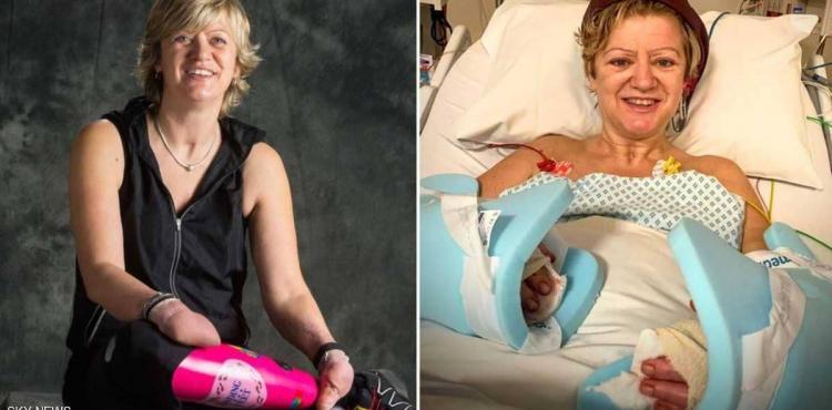 صورة السيدة مبتورة الأطراف