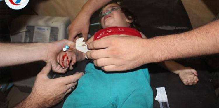 طفلة أصيبت بحالة اختناق جراء قصف حي جوبر