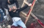 الشاب المصاب برصاص الاحتلال في الرام.png