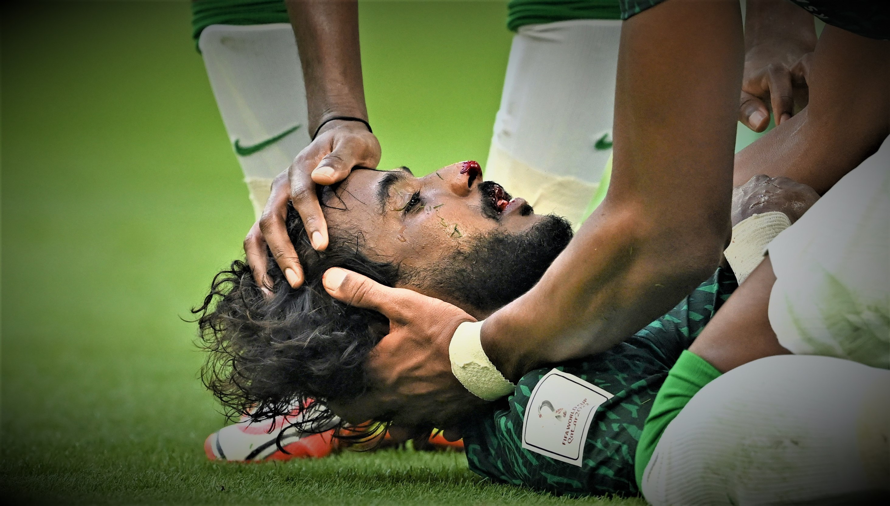 إصابة ياسر الشهراني هل انتهت مسيرته الكراوية.jfif