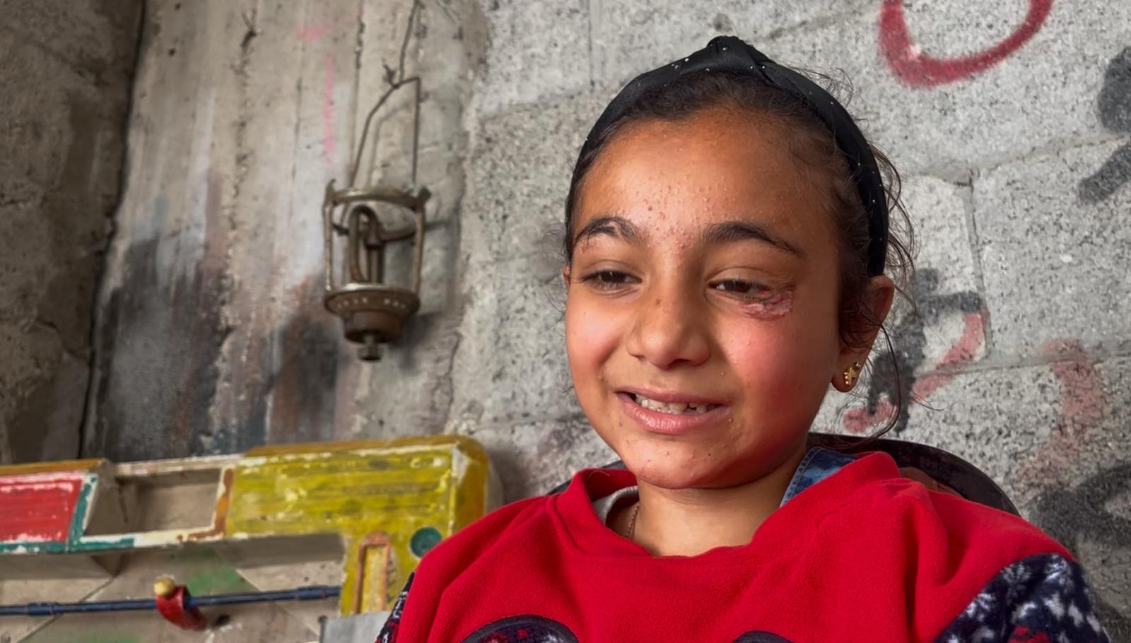 الطفلة ريماس خليفة الناجية الوحيدة من مجزرة إسرائيلية مرعبة