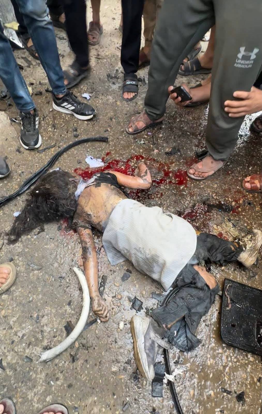 بالصور شهيدان بينهما طفلة و6 إصابات في غارة إسرائيلية غربي مدينة غزة
